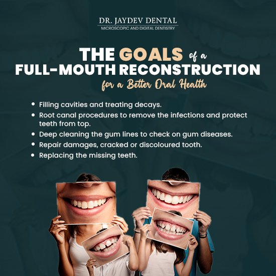 dental-problems-that-full-mouth-reconstruction-can-fix